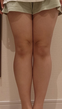 150cm62kgの中学生です 太ももが太太ももくらいになっ Yahoo 知恵袋