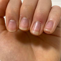 最近甘皮処理をセルフでしているのですが質問があります これ私の爪なんですけど Yahoo 知恵袋