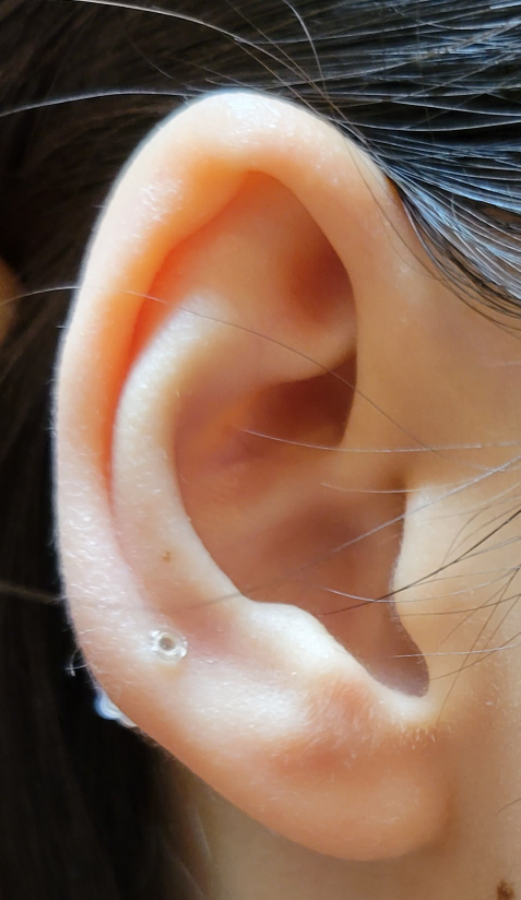 この耳にインダストリアルは無理ですかね？ また、どのようなピアスが開けられそうか教えてください。