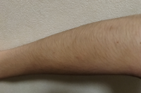 高校生男です 腕の毛が気になって半袖の服が着れません 濃いほうですか 薄いほ Yahoo 知恵袋