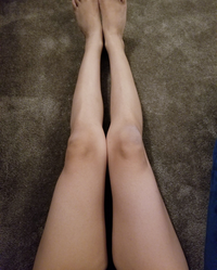 お見苦しい画像ですみません 骨格診断をしていたのですが 自分でみると膝の皿の Yahoo 知恵袋