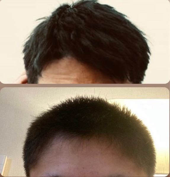 下の写真から上の写真の髪型まで何ヶ月かかると思いますか？髪に詳しい方お願いします。