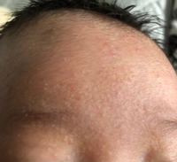 生後1ヶ月の赤ちゃんです 昨日石鹸泡で顔を洗ったのですが今日の朝肌 Yahoo 知恵袋