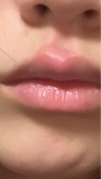 至急お願いします 突然唇腫れていて気になるんですけどこれって Yahoo 知恵袋