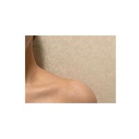この肩の盛り具合って、肩ボトックスしたほうがいいレベルですか？ 