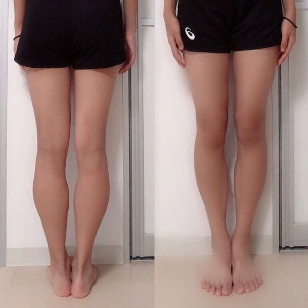 バレー部 太もも 