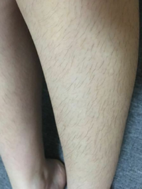 ムダ毛処理を一切しない女性はどういう印象ですか この女性は1年間一切ムダ毛の Yahoo 知恵袋