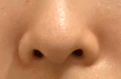 この鼻は何鼻だと思いますか？自分は鼻がすごくコンプレックスで綺麗な鼻にみえる方法(ノーズシャドウなど)や綺麗な鼻になる方法など教えてください。