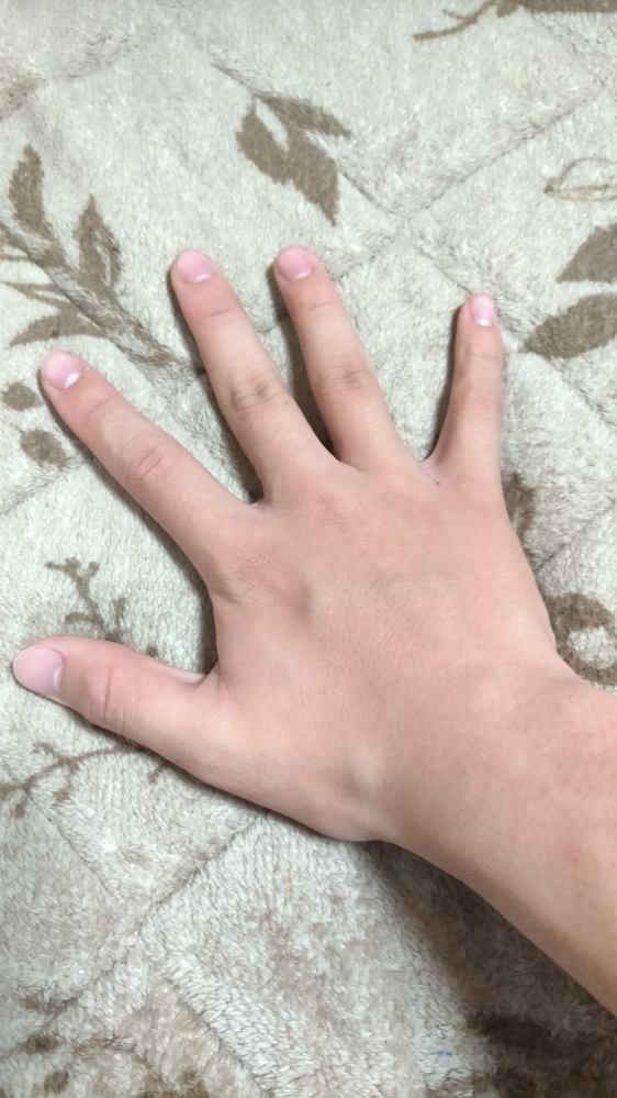 中学3年男子です。 骨格が関係してるのかもしれないのですが、指が太くてコンプレックスです。 どうやったら細くなりますか？何かアドバイスが欲しいです。