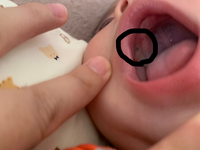4ヶ月の子供がウエスト症候群みたいな動きをしたので動画を撮って小児科 Yahoo 知恵袋