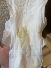 閲覧注意です 膣からこんな感じの白い塊がでてきました お Yahoo 知恵袋