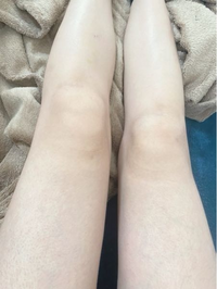 自分は膝の皿が大きいと思っているのですがこれは大きいのでしょうか Yahoo 知恵袋