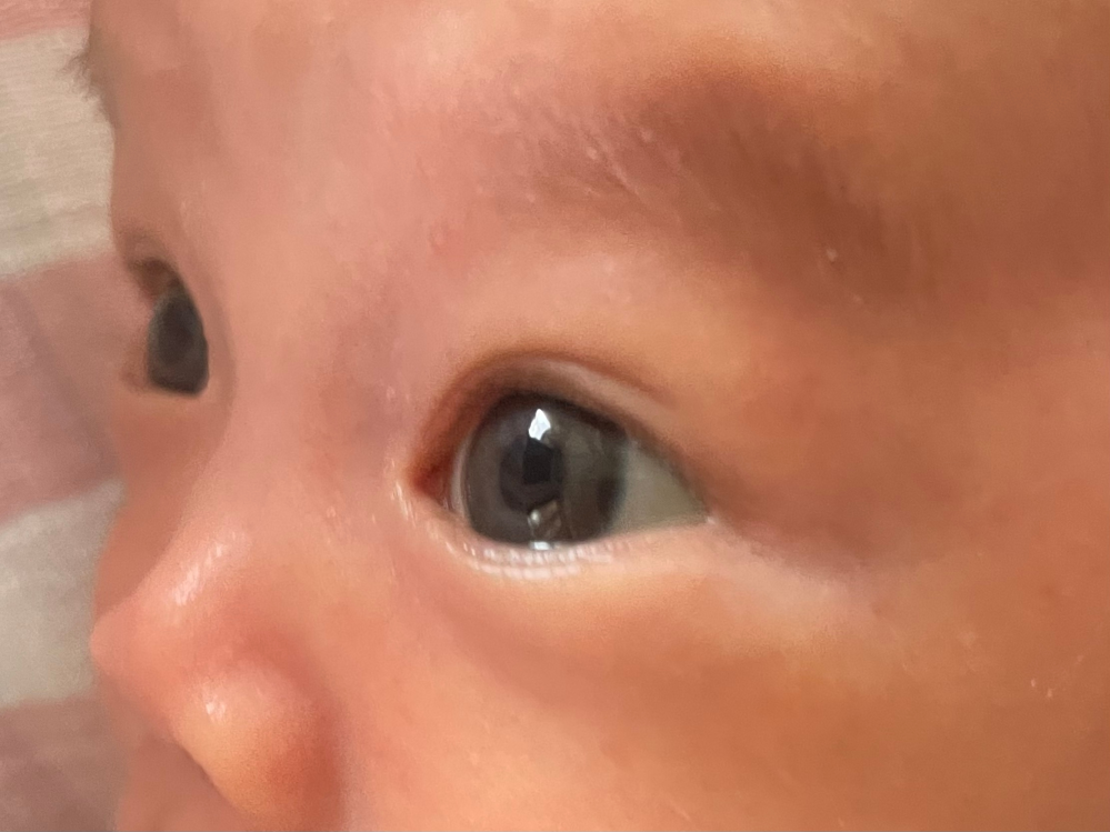生後1ヶ月の男の子の目が、グレー？ やや青っぽいです。旦那 私共に日本人で旦那が薄い茶色 私は完全に濃い茶色です。何故この様な色の瞳になるんでしょうか。。