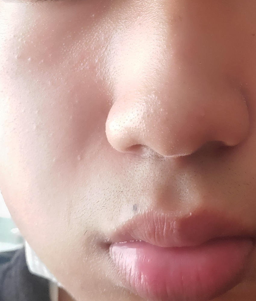 左側の部分の頬が汚いです。どうしたらきれいになりますか?