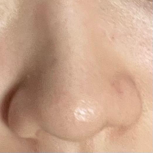 この鼻をマッサージ等で自力で小さくさせる方法はありますか？