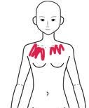 姿勢を普通にしててもピンクの部分の鎖骨〜胸あたりが伸びる？引っ張られる？みたいな違和感があります。 何故なんでしょうか？ 出来れば治したいです