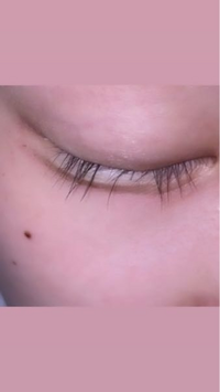 この まつ毛のない部分を増やすにはどうしたらいいですか なんのまつ Yahoo 知恵袋