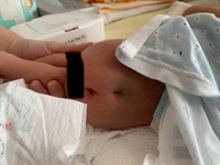 Zehn様の回答希望 おしりの画像があります赤ちゃんのお尻の上 Yahoo 知恵袋