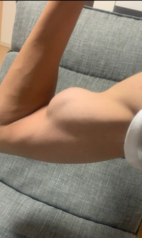 この腕 細マッチョに入りますか 中3 テニス部です Yahoo 知恵袋