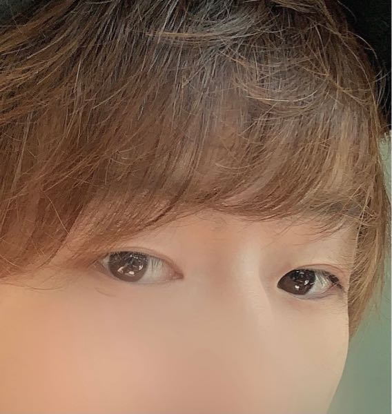 湘南美容での二重整形を考えています 完全に一重で3年前から毎日テープで二重を Yahoo 知恵袋