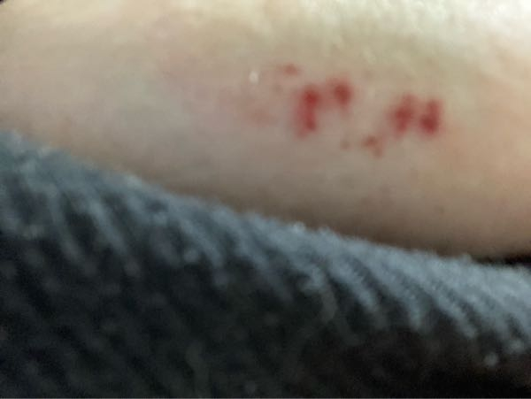 女性の病気 解決済みの質問 Yahoo 知恵袋