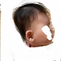 生後4ヶ月の子どもの頭の形が斜め後ろに長いのですが これは自然には Yahoo 知恵袋