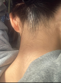 うなじと背中の毛について 中一女子です 私は元々ムダ毛が濃 教えて しごとの先生 Yahoo しごとカタログ