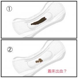 避妊 すべての質問 Yahoo 知恵袋
