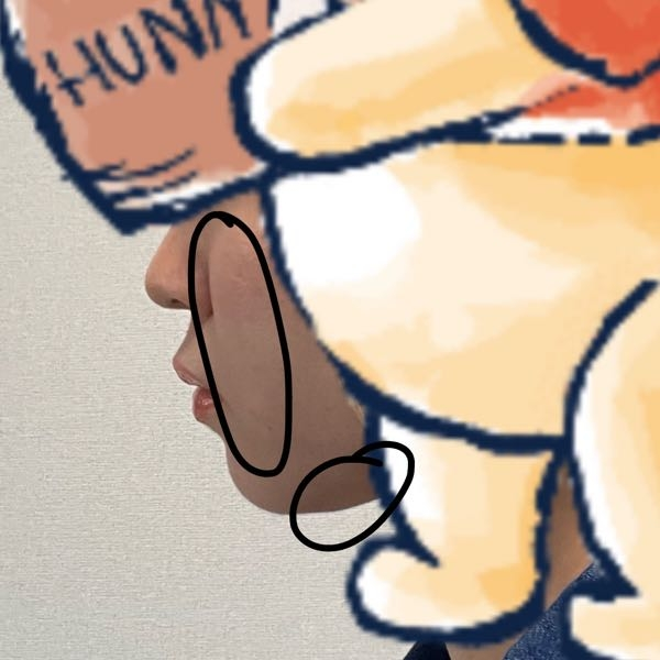 この顔のお肉はどうしたら落ちますか？