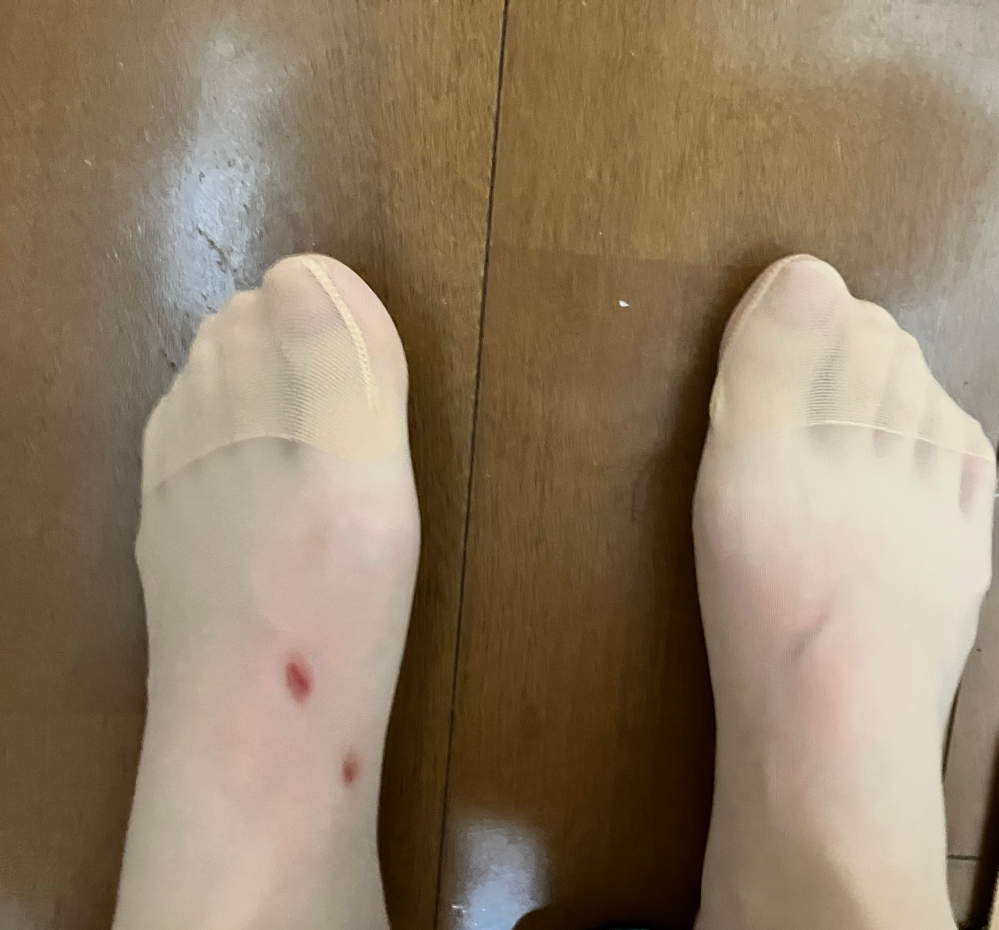 靴擦れについて質問です。 服屋で試し履きをして買ったパンプスが、実際に使ってみると家を出て10分としないうちに足が痛くなってきて、脱いでみたら画像のように靴擦れを起こしていました。パンプスの甲の穴あき部分？の形に沿ってという感じです。このような靴は、どのようにしたら自分に合うようになるのでしょうか？また、そのようなアドバイスをいただけるお店などはありますか？靴の素材は合成皮革です。