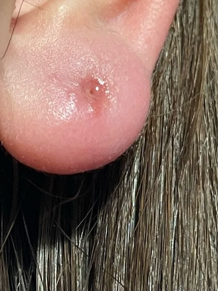 ピアスを開けている方もあけていない方も！カフス NAVETA ピアッサーでピアスを開けたのですが、シャフト部分が前に出て