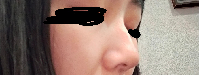 この鼻って種類でいうと何鼻ですか？ 高いですか低いですか…？