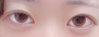 汚い写真失礼します
この左右非対称すぎる目って整形とかじゃないとどうにもなりませんか？
また、ましにする方法などないですか？ それと、上目遣いをするくせがあったら三白眼になる可能性があるという記事を見た事あるのですが、逆に下を見るくせをつけたら緩和されるとかってないですよね、？