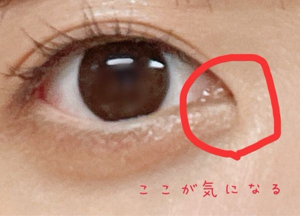 美容整形に詳しい方教えてください。 美容整形を一度もしたことがありません。 最近、蒙古襞が気になります。 写真写りが良くなりたい、目が大きくなりたい そんな気持ちがあり蒙古襞を切除するか悩んでいます。 一見蒙古襞がないように見られがちですが、きちんと見るとしっかりあります。 ふくれなちゃんのようになれたらうれしいです。 アドバイス等あればよろしくお願いします。