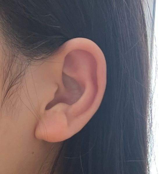 インダストリアルを開けたいと考えているのですが開けられない耳があると聞きました これは開けられる耳ですか？
