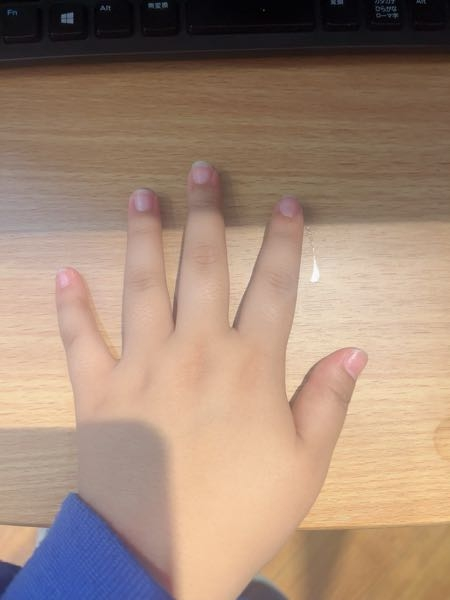 至急お願いします ダメ元でネイルモデルに応募したら当選してしまいました。 しかし私は手が綺麗じゃないんですけど大丈夫ですかね？下のような手をしてます。
