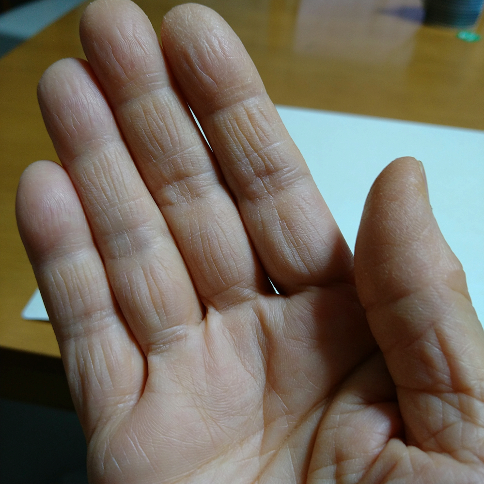 ご質問致します。 右手小指の縦筋は俵紋ですか。 しわでしょうか。 薬指にもあります。 わかる方鑑定を何卒お願い致します。