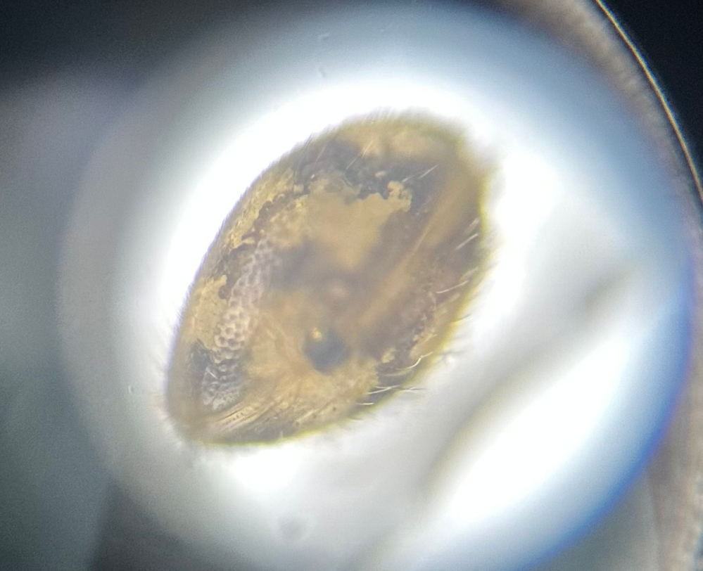 微生物についての質問です メダカの水槽にいました この生物は何なのでしょうか？ 貝のような？なかなかすばしっこいです 大きさはギリギリ目で見れるぐらいで0.5mmぐらい？です 写真は顕微鏡100倍で撮ったものを少し拡大したものです よろしくお願いします