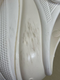 白のクロックスの擦れ汚れはどうやったら落ちますか？ウタマロ石鹸で  