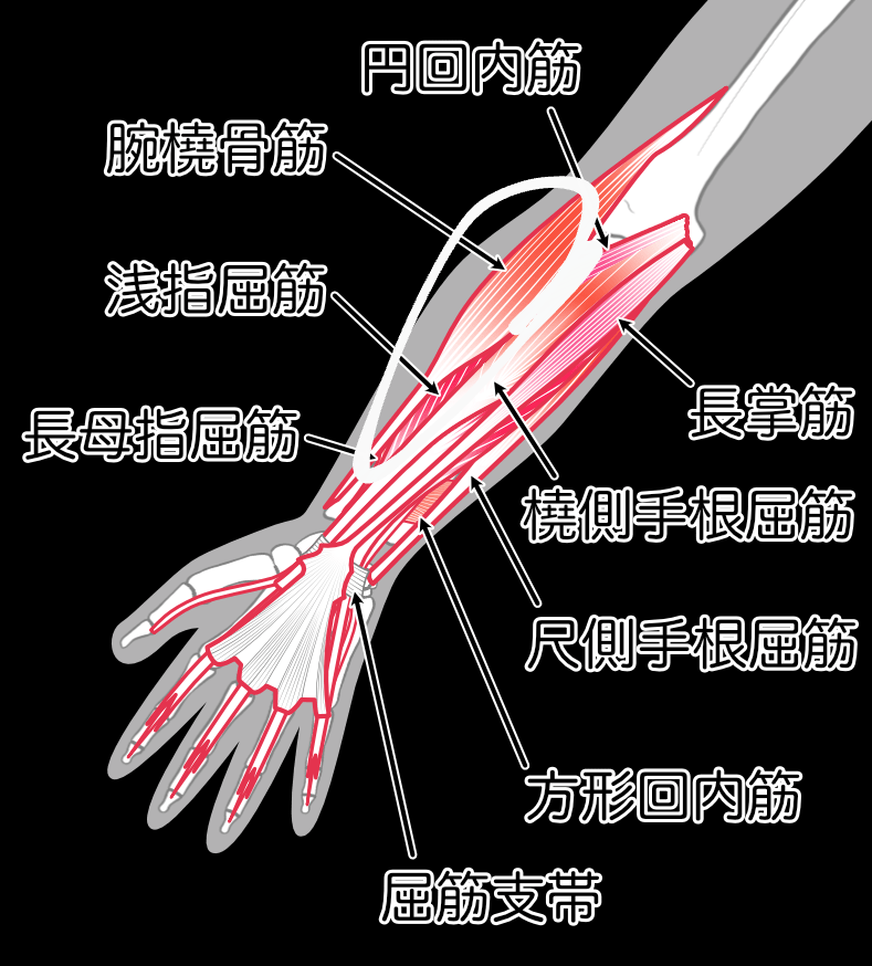 ボクシングでパンチを出すとこの部分が痛くなるんですけどどうやって改善すればいいですか？筋を痛めてるのか筋肉を痛めてるのかも教えてほしいです