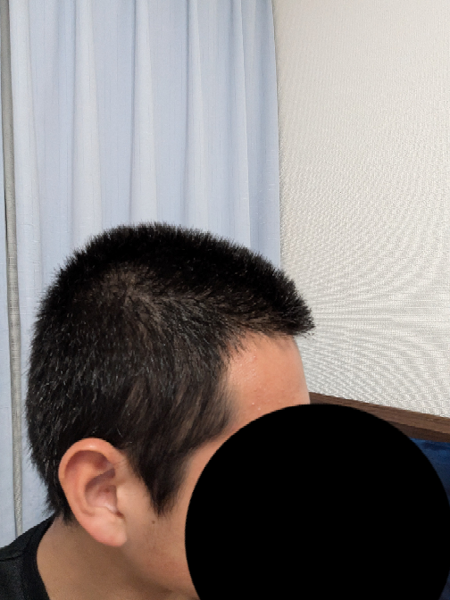坊主にしてからもう少しで2ヶ月経つのですが、今の髪の毛にくせ毛はあ