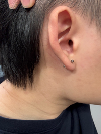 自分でピアスを開けたのですが、この角度で大丈夫ですか？正解が分から 