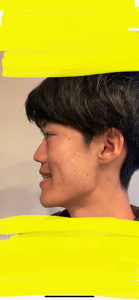 19歳学生です。これは受け口になってるでしょうか？横顔として綺麗な方 