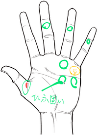 怪我について質問です。私は弓道をやっているのですが、弓手の