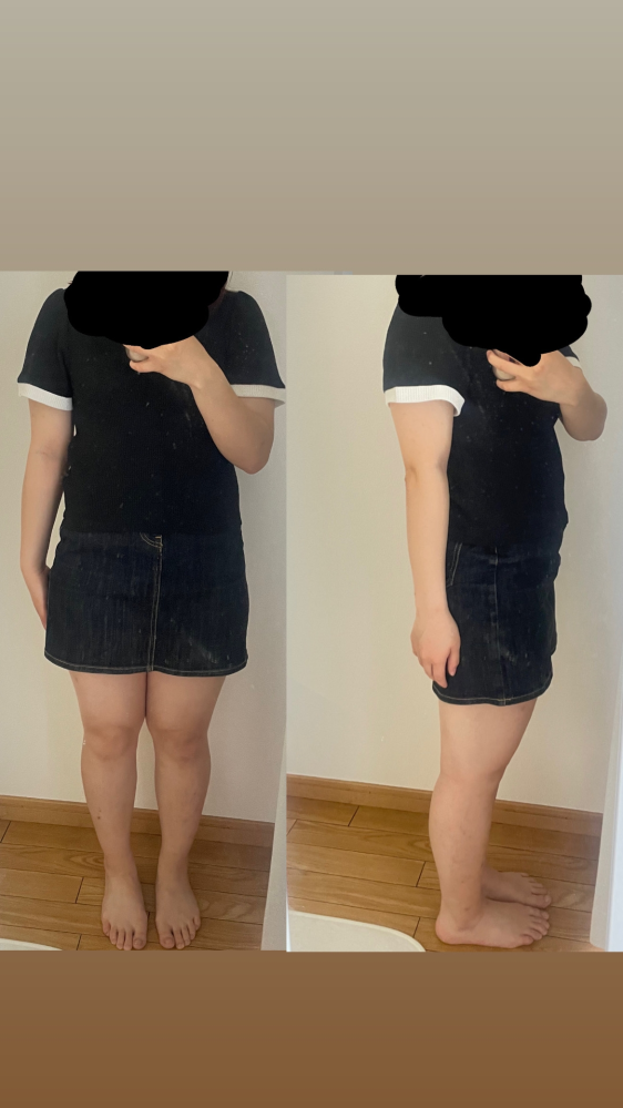 自分の体型について質問です この体型見てどう思いますか？ 客観的な意見が聞きたいです ほんとに率直にたくさん言ってください。 身長151センチで体重53キロですありえないですよね豚です 自分では、毎日毎日鏡見て醜あと思っています涙が出ます。 今はまだ長袖でまじですが夏がもう直前で恐ろしいです来ないでほしいです。 ダイエットしようと、食べ物を置き換えてみたりしてますが、生理が来ると爆買いしてその度に自己嫌悪になって頭おかしくなりそうです おすすめのダイエット教えてください夏までには痩せたいです カリカリになりたいです醜いです