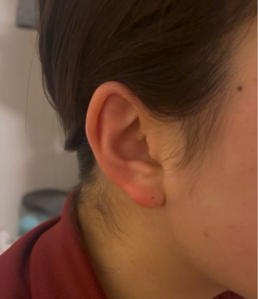 ピアスを開ける位置にすごく迷ってます！ 画像付きでご回答いただけるととてもありがたいです！ “耳たぶ以外で”どこに開けたらピアスがはえるでしょうか？ ヘリックスは可愛いとは思うのですが私の耳の形では似合うかどうか分からないので、似合うかどうかの客観的な意見もいただきたいです！