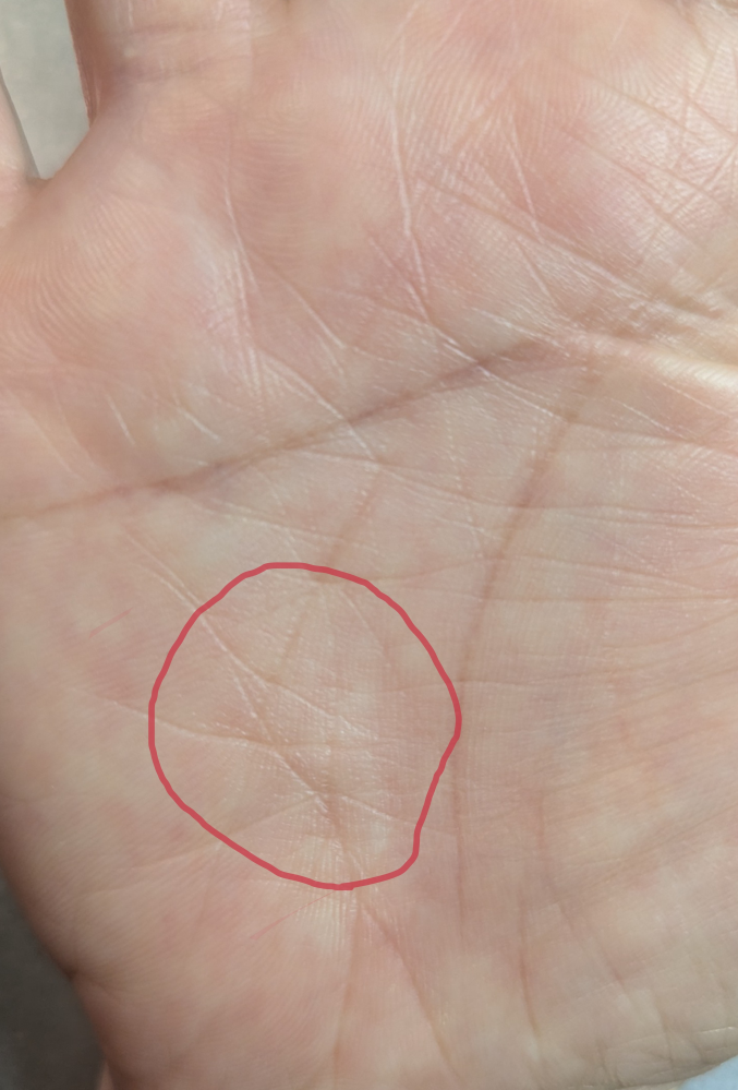 手相について質問させて下さい。赤丸の部分は五芒星ですか？宜しく 