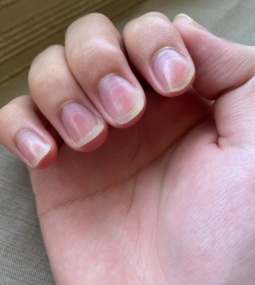 先程ジェルネイルをした爪をぶつけてしまい見にくいですががぞうのよ... - Yahoo!知恵袋