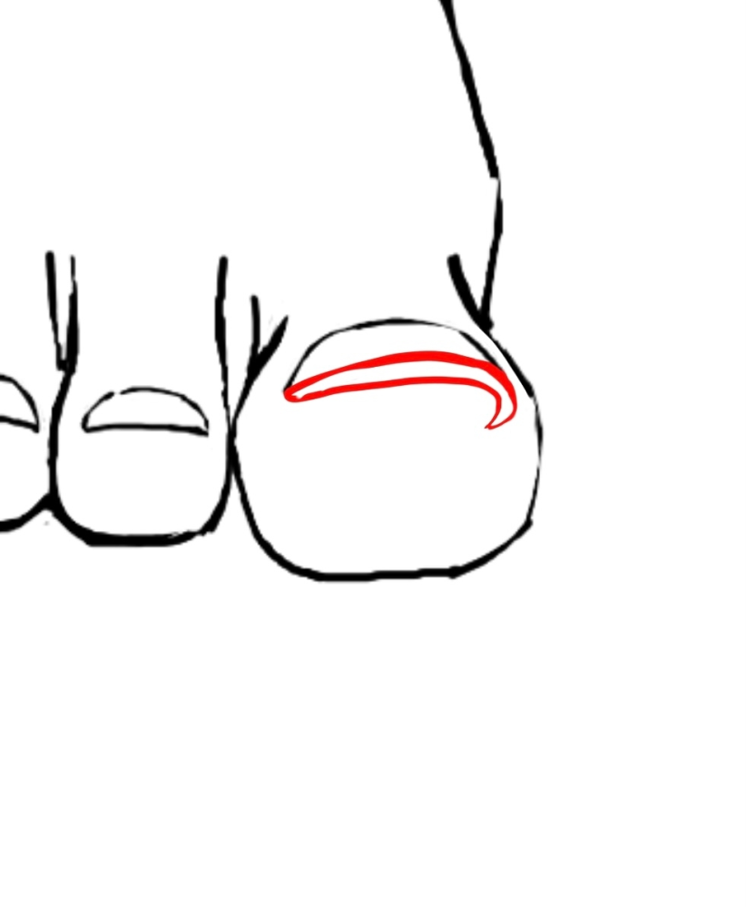 マットジェルが一部なかなか乾かないことがよくあるんですがこれ... - Yahoo!知恵袋