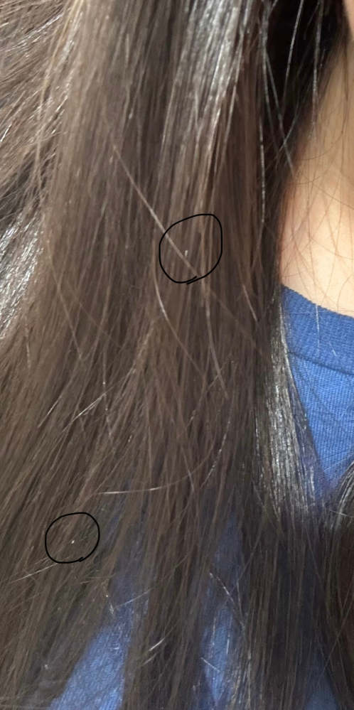 見にくいですが、この髪の毛に白い粒？みたいなのが最近よく付いてるん 